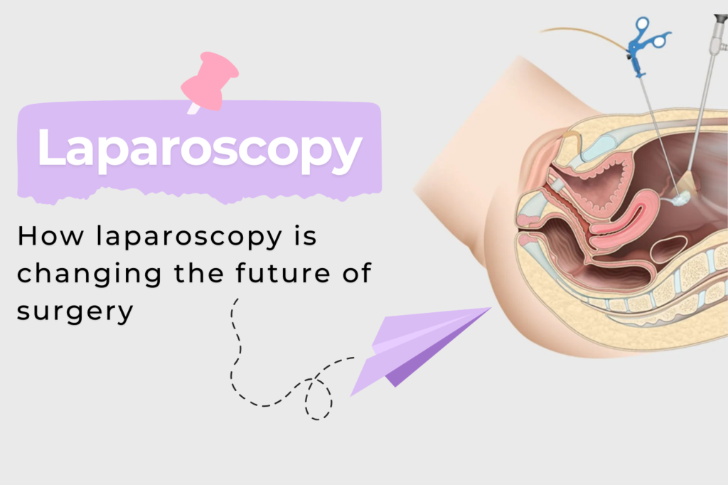 How Laparoscopy is Revolutionizing Surgery: A Look at Minimally Invasive Techniques