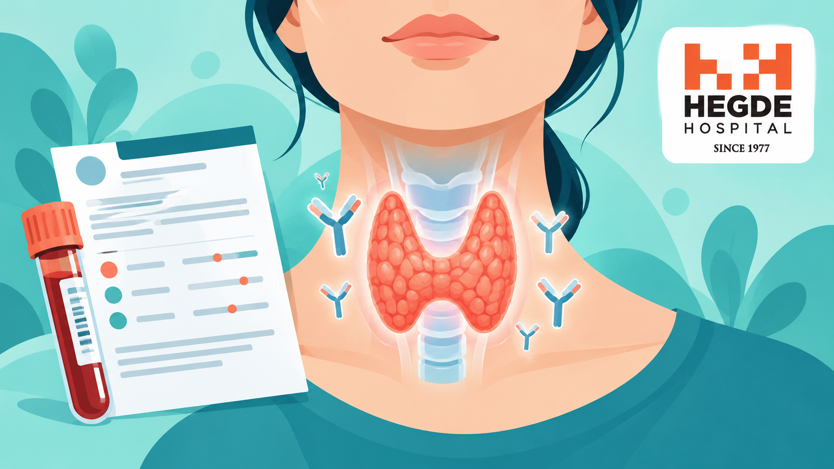 Hashimoto Thyroiditis: What Positive Antibodies Mean